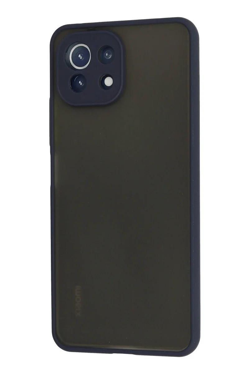 Newface Xiaomi Mİ 11 Lite Kılıf Montreal Silikon Kapak - Lacivert