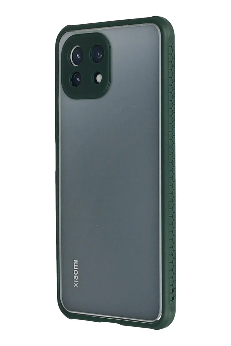 Newface Xiaomi Mİ 11 Lite Kılıf Miami Şeffaf Silikon - Koyu Yeşil