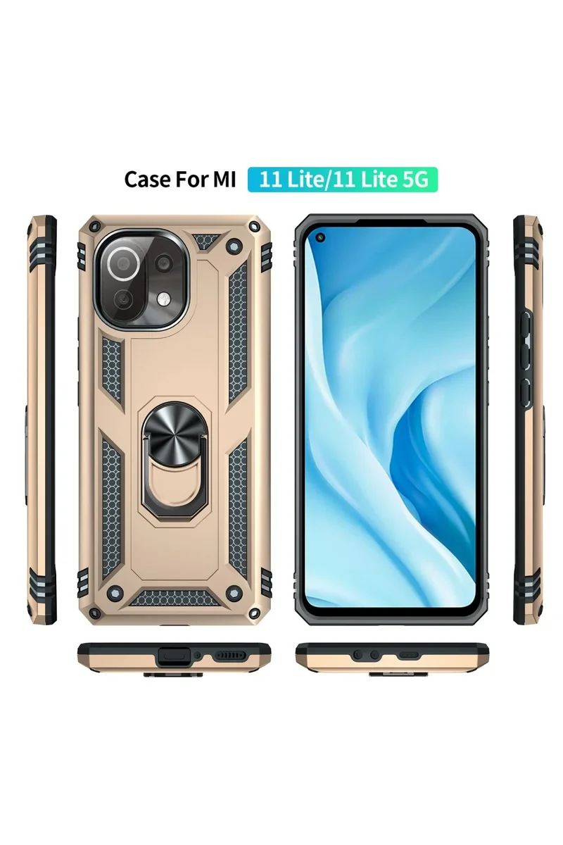 Newface Xiaomi Mİ 11 Lite Kılıf Sofya Yüzüklü Silikon Kapak - Gold